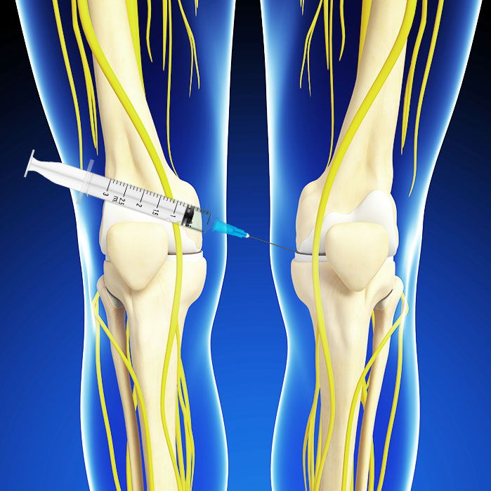 hyalgan knee injections in Garland